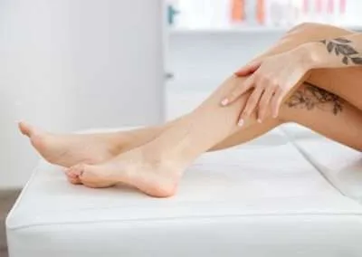Medical professional performing sclerotherapy, injecting a solution into a varicose vein, with the vein and syringe in focus against a clinical background.